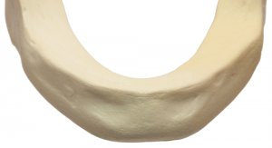 Whats-In-a-Bone-Graft