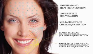 Platelet_Rich_Plasma_Treatment_in_Delhi_640x376