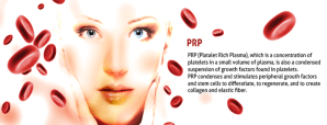 PRP-treatment